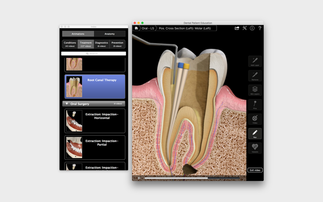 Dental Patient Education(圖3)-速報App