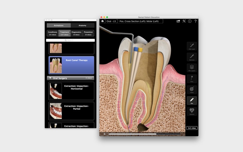 Dental Patient Education screenshot1