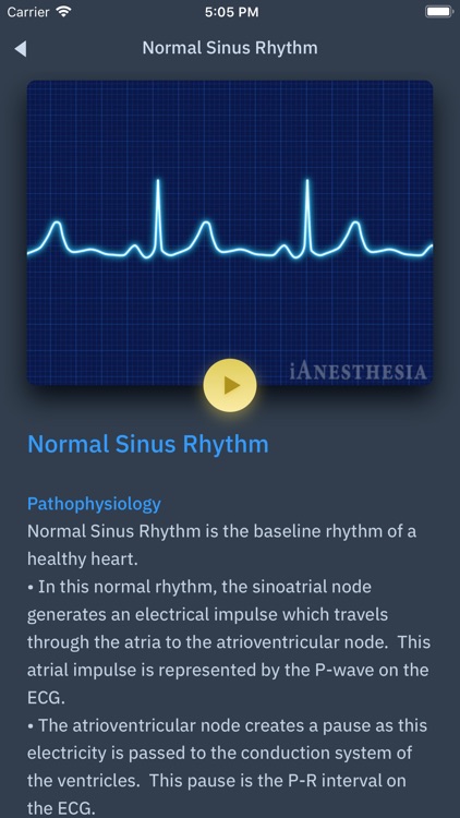 ACLS Rhythms and Quiz screenshot-3