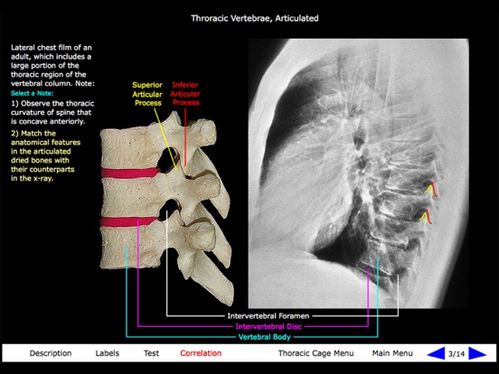 Gross Anatomy of the Skeleton screenshot 3