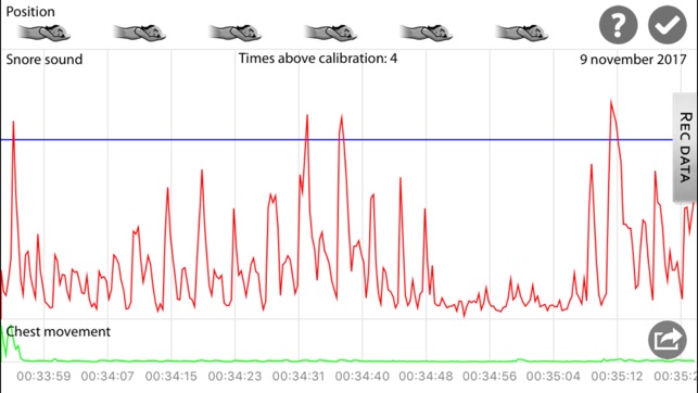 SnoreMonitorSleepLab(圖3)-速報App