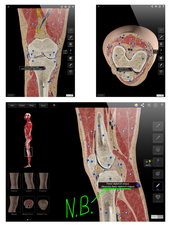 Knee Pro III for iPadのおすすめ画像3