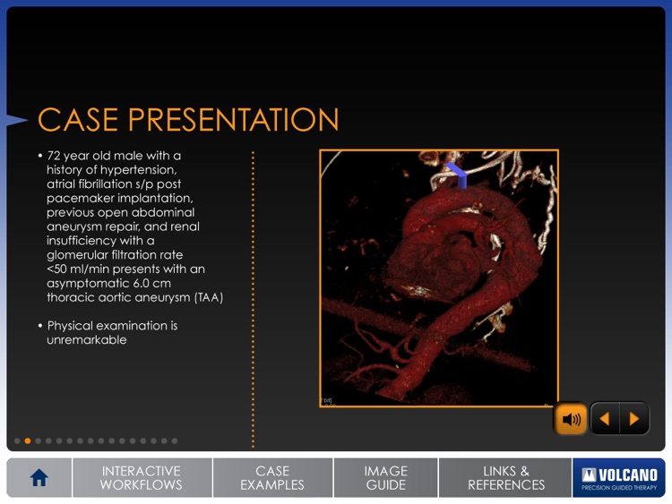 Aortic IVUS