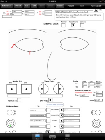 OphthyChart screenshot 2