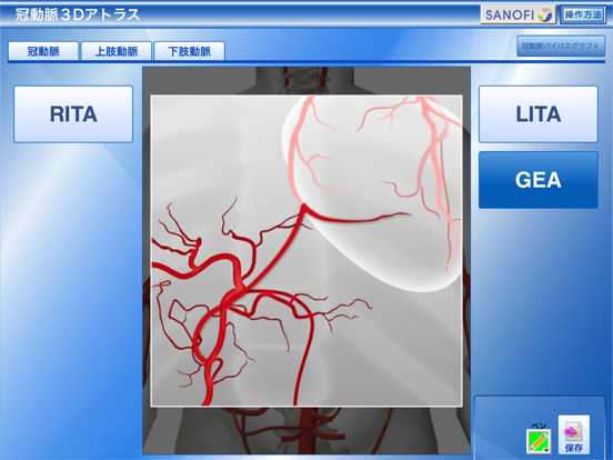 冠動脈3Dアトラスのおすすめ画像5