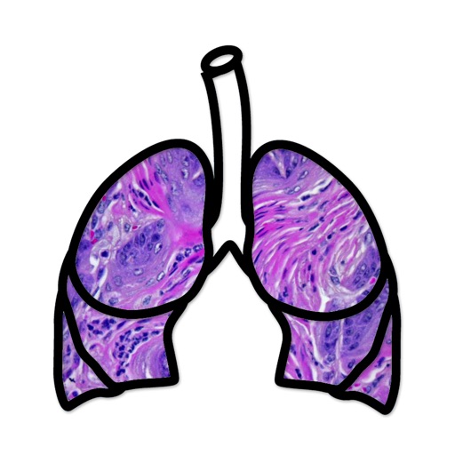 Lung Cancer Stage
