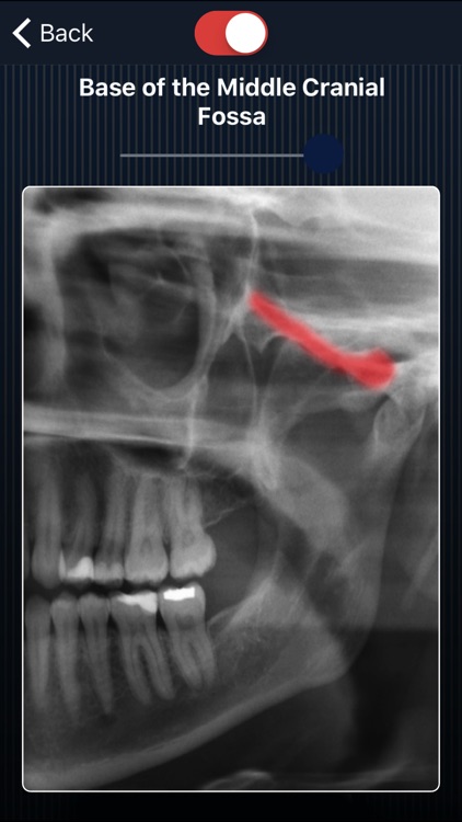 Dental Panoramic Radiology