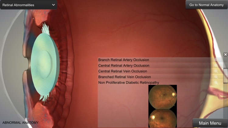 Eye Anatomy screenshot-3