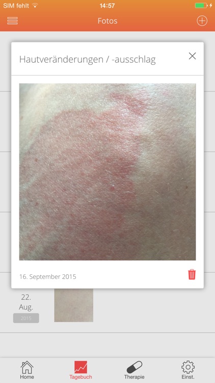 LupusLog Switzerland screenshot-5