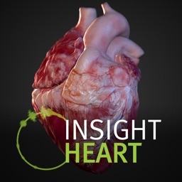 INSIGHT HEART Apple Watch App
