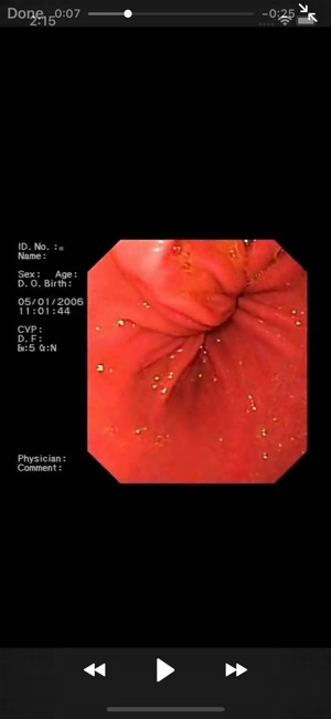 ENDO3® Gastrointestinal Atlas(圖4)-速報App