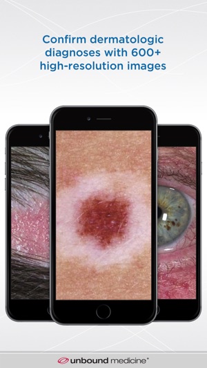 Dermatology DDx(圖1)-速報App