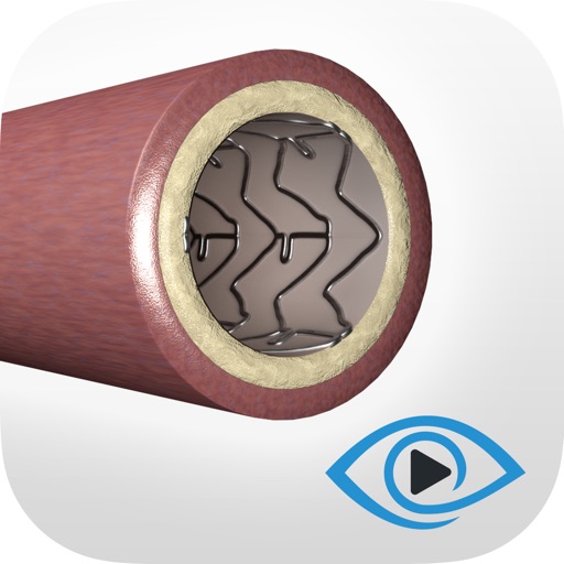 Coronary Angioplasty Training
