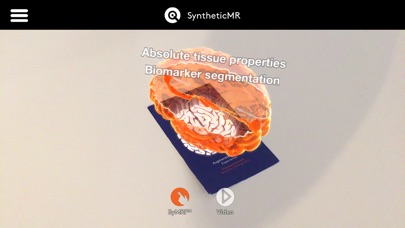 SyMRI AR screenshot 2