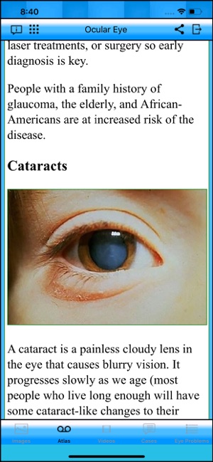 Ocular Eye(圖2)-速報App