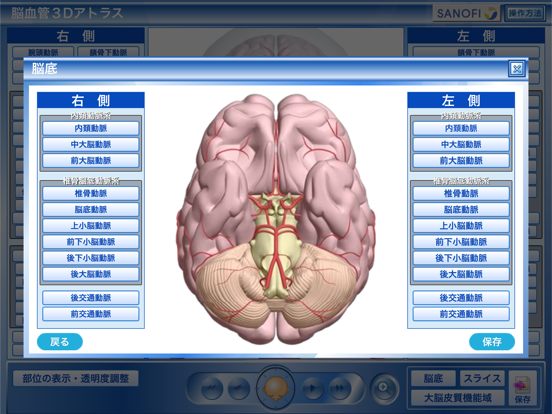 脳血管3Dアトラスのおすすめ画像4