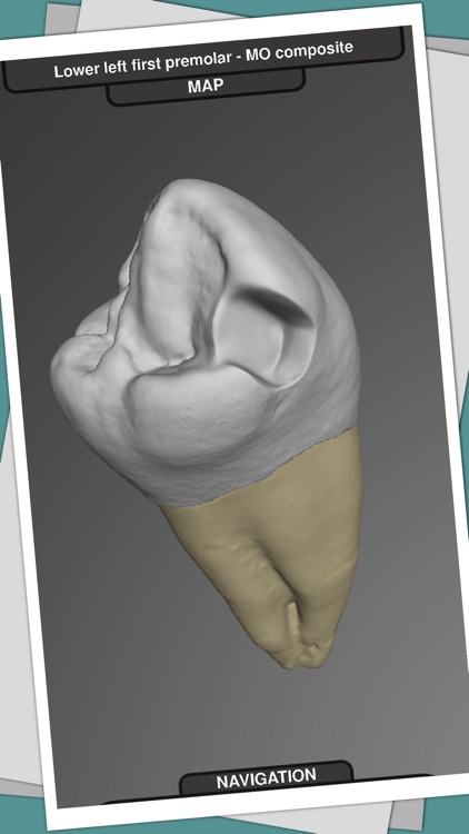 CavSim : Dental Cavity Preps