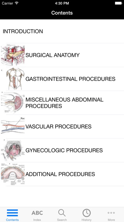 Zollingers Atlas of Surgery