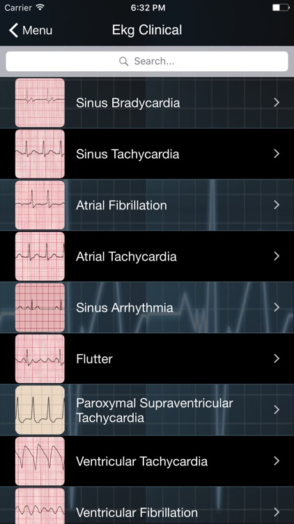 EKG Clinical