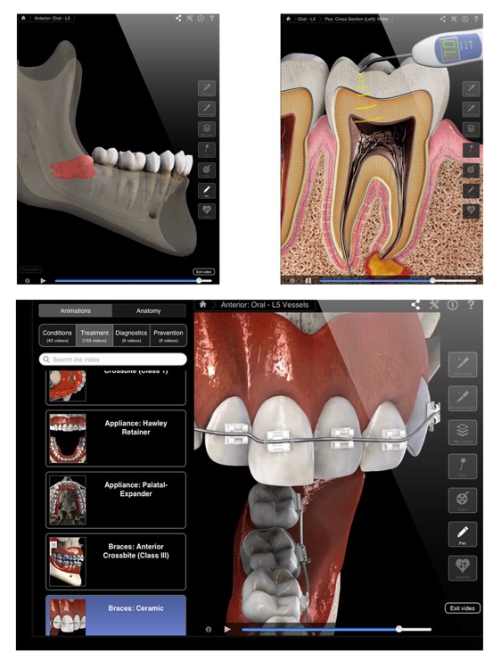 Dental Patient Education