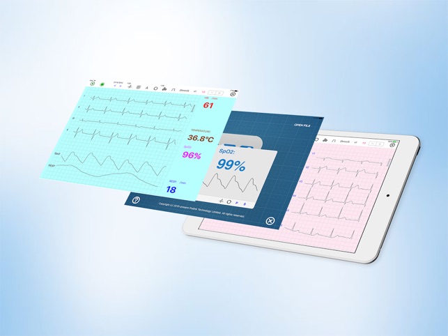 UltraLS HD  ECG SpO2 TEMP(圖3)-速報App