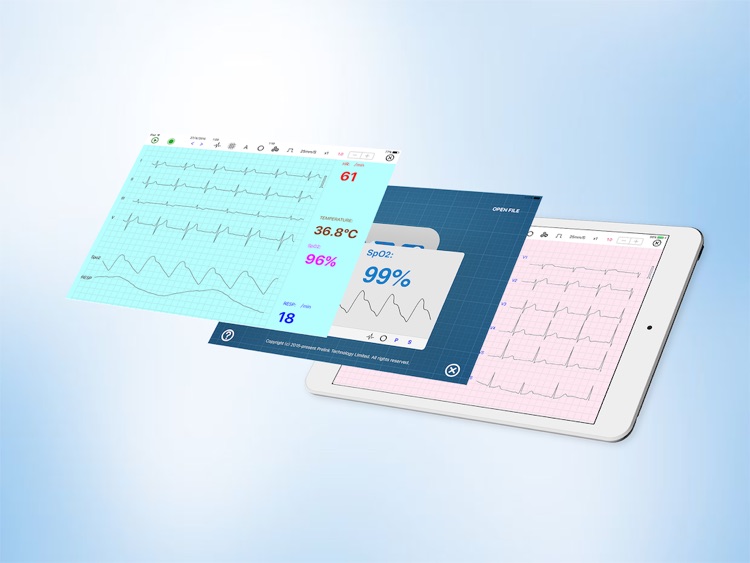 UltraLS HD  ECG SpO2 TEMP