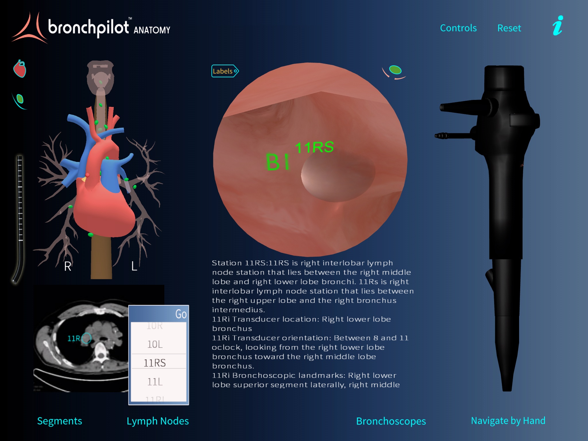 BronchPilot ANATOMY screenshot 4