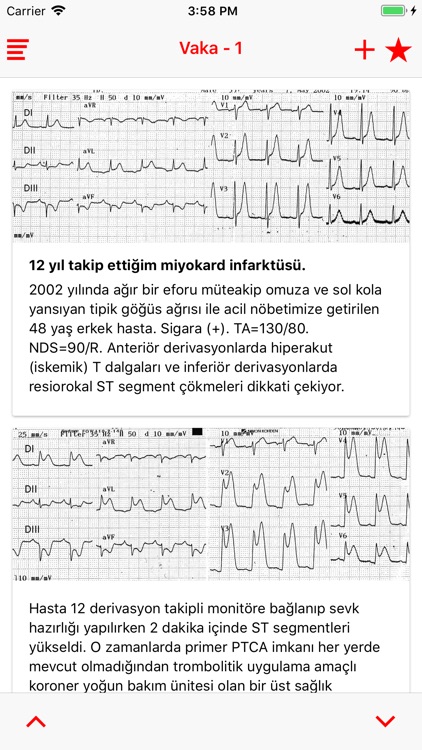 Acil EKG screenshot-4