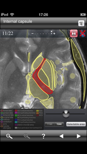 Brain MRI Sectional Walker(圖4)-速報App