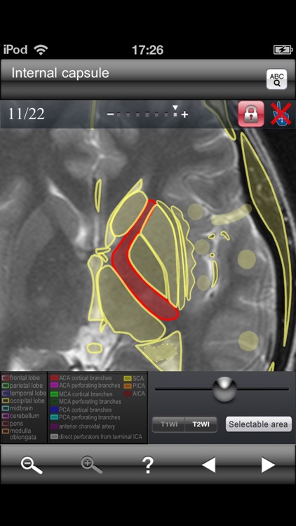 Brain MRI Sectional Walker screenshot-3