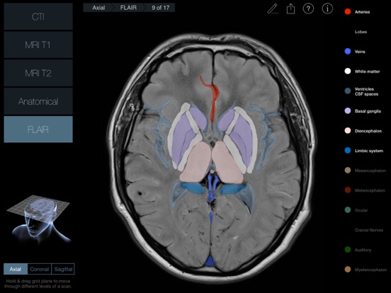 Radiology - Headのおすすめ画像1