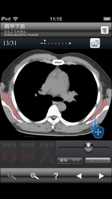 断面図ウォーカー胸部CTのおすすめ画像2