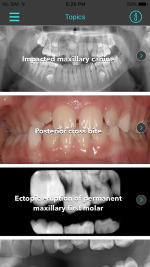 Interceptive Orthodontics(圖2)-速報App