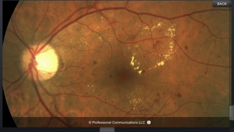 Eye Anatomy screenshot-4