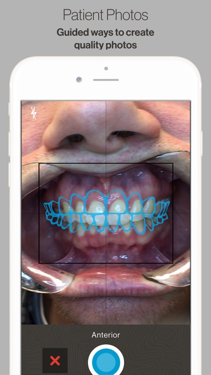 Invisalign Photo Uploader
