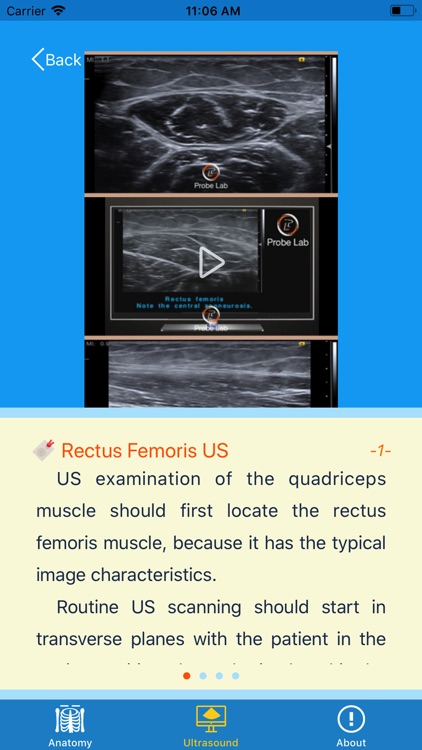 MSK Ultrasound: Thigh