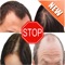 Almost 85% of all men and 50% of women in the USA suffer from hair loss during their lifetime