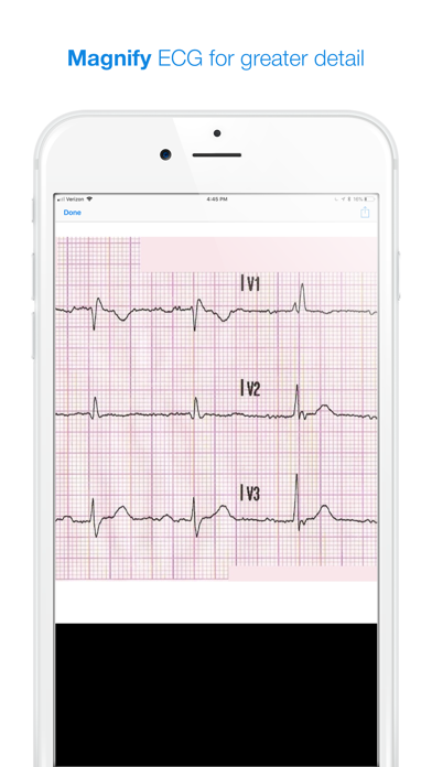 12 Lead ECG Challenge Screenshot 5