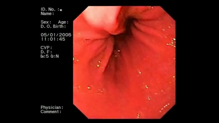 ENDO3® Gastrointestinal Atlas screenshot-4