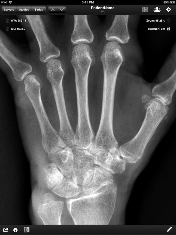 Jack Imaging Medical