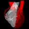 AngioTeacher is an interactive virtual simulator and self-learning medical software application to help cardiologists and students acquire advanced skills to interpret coronary angiograms