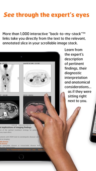 Radiology - CRC Staging Atlas screenshot 4