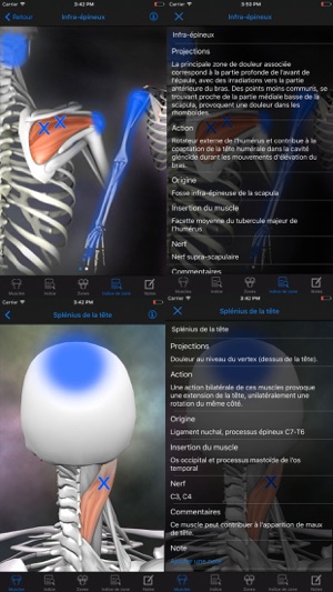 Trigger Points Myofasciaux(圖5)-速報App