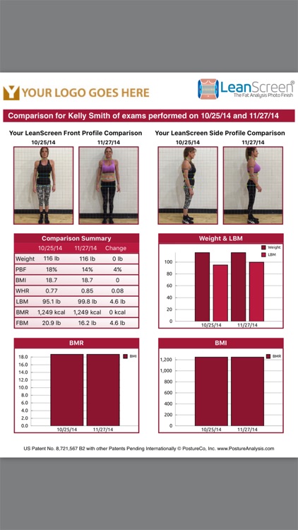 LeanScreen: Body Fat Analysis from Photos