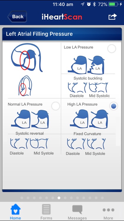 iHeartScan screenshot-3