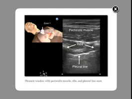 Game screenshot Trauma Ultrasound eBook mod apk