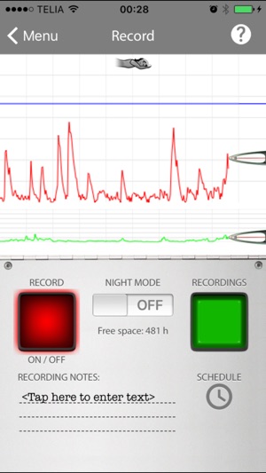 SnoreMonitorSleepLab(圖2)-速報App