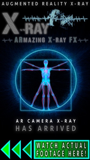 ARmazing X-Ray FX(圖1)-速報App