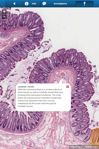 Smart Histology Lite screenshot 4