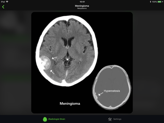 iRadiologist - Brainのおすすめ画像4